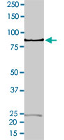 2 &mu;g/lane SDS-PAGE Stained with Coomassie Blue